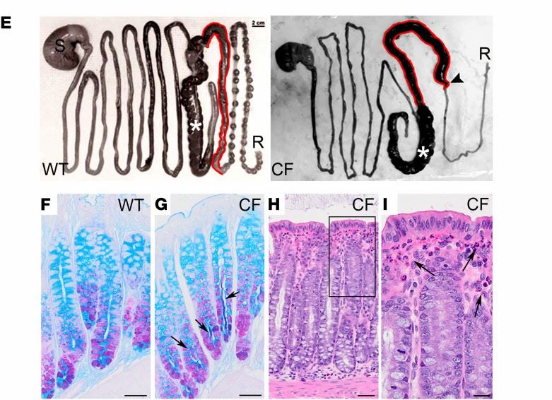 Altered gastrointestinal function in CF rabbits.